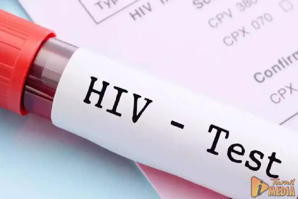 இளைஞர்களிடையே HIV தொற்று அதிகரிப்பு